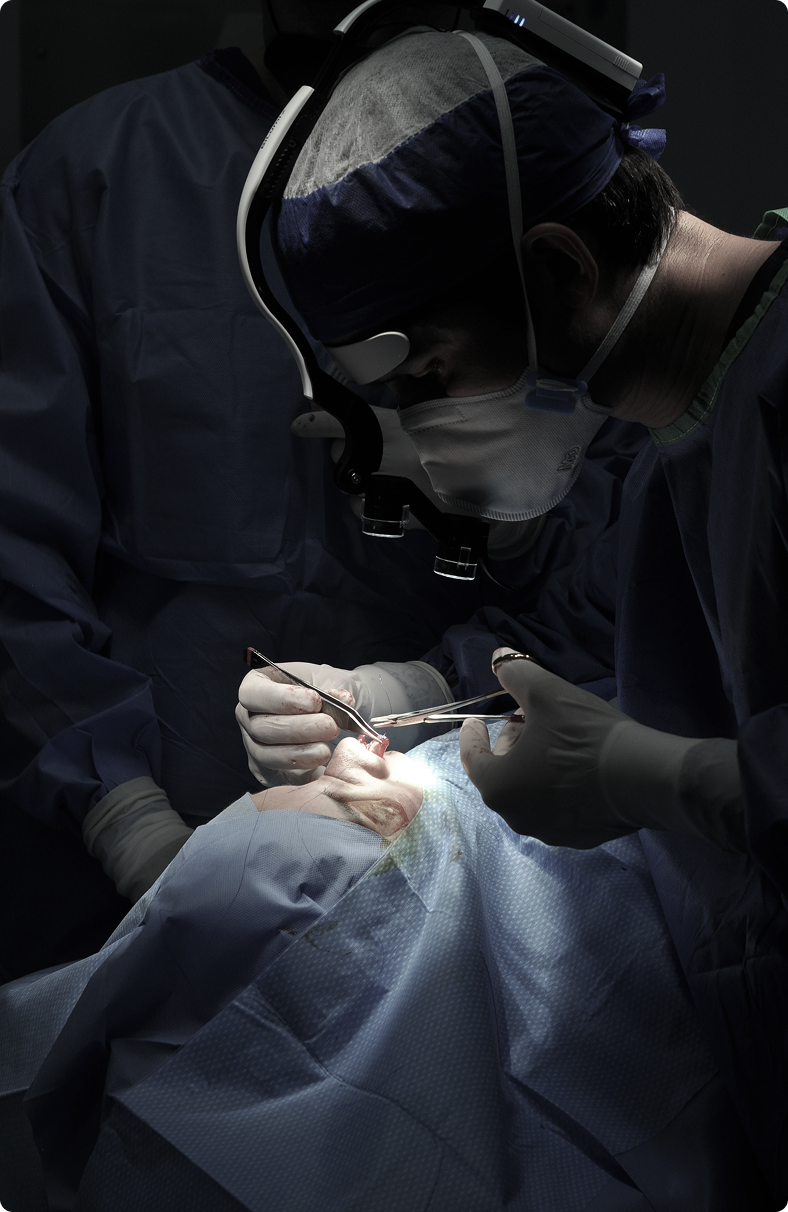 Rinoplastia abierta — abordaje quirúrgico
